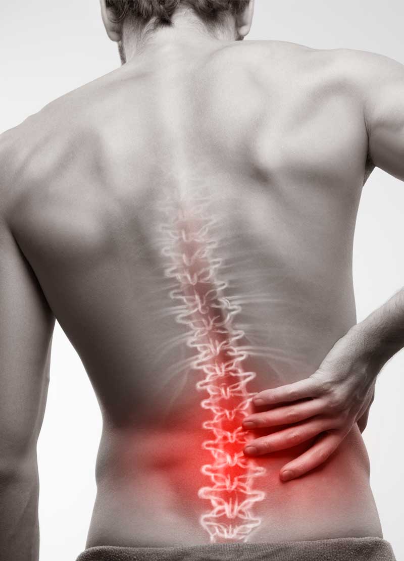 Degenerative Disc Disease: Everything You Need to Know