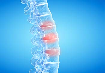 Spine-Stimulation
