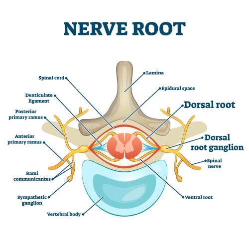Dorsal_Root_Ganglion